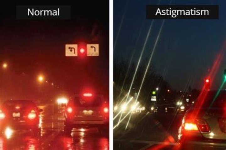 A Guide To How Astigmatism Lights Look Blog Eyebuydirect