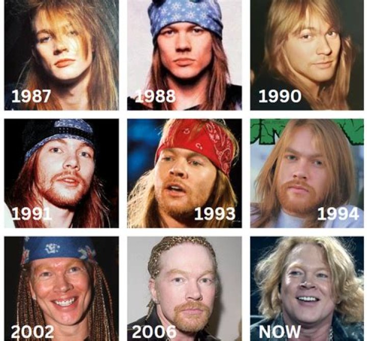 Axl Rose: Evolution Of An Icon