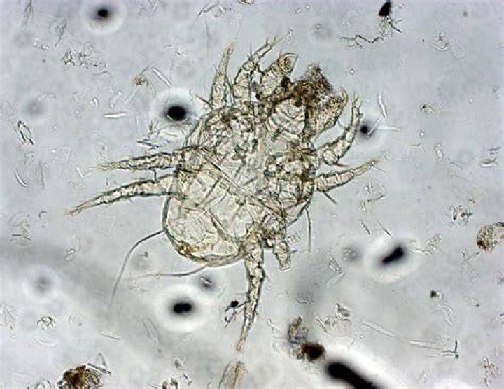 What’s Eating You? Cheyletiella Mites MDedge Dermatology
